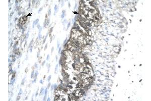 ACAT2 antibody was used for immunohistochemistry at a concentration of 4-8 ug/ml to stain Ganglionic cells (arrows) in Human Stomach. (ACAT2 anticorps)