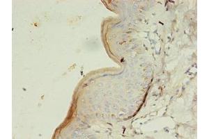 Immunohistochemistry of paraffin-embedded human skin tissue using ABIN7154151 at dilution of 1:100 (GK3P anticorps  (AA 1-220))
