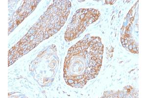 Formalin-fixed, paraffin-embedded human Pancreas stained with Spectrin Beta 3 Rabbit Monoclonal Antibody (SPTBN2/2979R).