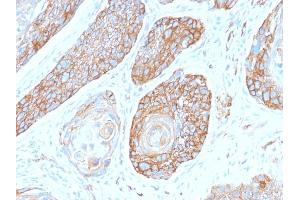 Formalin-fixed, paraffin-embedded human Pancreas stained with Spectrin Beta 3 Rabbit Monoclonal Antibody (SPTBN2/2979R). (Recombinant Spectrin, Beta, Non-erythrocytic 2 (SPTBN2) (AA 356-475) anticorps)