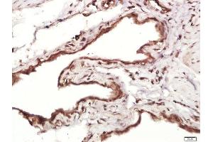 Paraformaldehyde-fixed, paraffin embedded rat bladder, Antigen retrieval by boiling in sodium citrate buffer (pH6.