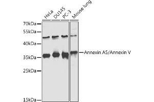Western blot analysis of extracts of various cell lines, using Annexin /Annexin V antibody  at 1:1000 dilution. (Annexin V anticorps  (AA 1-320))