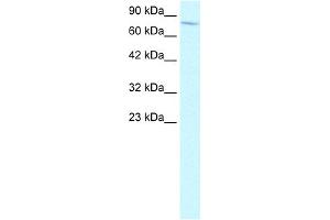 WB Suggested Anti-ENG Antibody Titration:  2. (Endoglin anticorps  (N-Term))