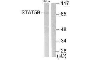 Western blot analysis of extracts from RAW264. (STAT5B anticorps  (Ser731))