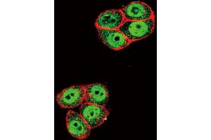 Confocal immunofluorescent analysis of Phospho-SD2- Antibody (ABIN650816 and ABIN2839794) with Hela cell followed by Alexa Fluor 488-conjugated goat anti-rabbit lgG (green).