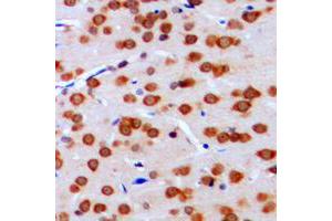 Immunohistochemical analysis of TCFL4 staining in human brain formalin fixed paraffin embedded tissue section.