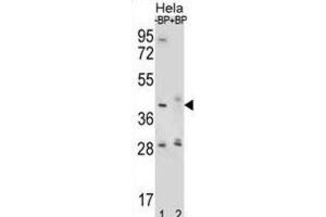 Western Blotting (WB) image for anti-Hyaluronidase-2 (HYAL2) antibody (ABIN2996780) (HYAL2 anticorps)