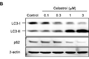 Celastrol activates autophagy and inhibits MPP+-induced neurotoxicity in dopaminergic neurons.