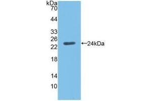 C19ORF80 anticorps  (AA 16-198)