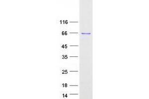 Validation with Western Blot
