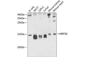 Western blot analysis of extracts of various cell lines, using MRPS6 antibody (ABIN6133092, ABIN6144048, ABIN6144049 and ABIN6225227) at 1:1000 dilution. (MRPS6 anticorps  (AA 1-125))