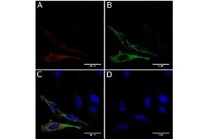 Immunofluorescence staining of fixed HeLa cells expressing mCherry tagged GCN4 with anti-GCN4 antibody C11L34. (Recombinant GCN4 anticorps)