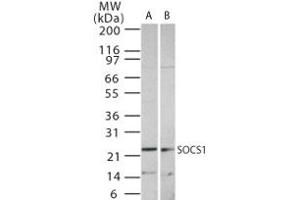 Image no. 1 for anti-Suppressor of Cytokine Signaling 1 (SOCS1) (AA 54-68) antibody (ABIN233230) (SOCS1 anticorps  (AA 54-68))