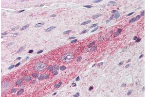 Human Small Intestine, Myenteric Plexus: Formalin-Fixed, Paraffin-Embedded (FFPE)