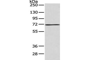 Gel: 8 % SDS-PAGE, Lysate: 40 μg, Lane: 293T cell, Primary antibody: ABIN7128186(ACSM5 Antibody) at dilution 1/200 dilution, Secondary antibody: Goat anti rabbit IgG at 1/8000 dilution, Exposure time: 30 seconds (ACSM5 anticorps)
