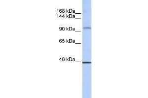 WB Suggested Anti-REST Antibody Titration:  0. (REST anticorps  (Middle Region))