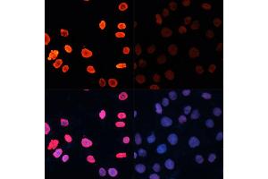 Immunofluorescence analysis of HeLa cells using Acetyl-Histone H3-K18 antibody (ABIN7267668) at dilution of 1:100.