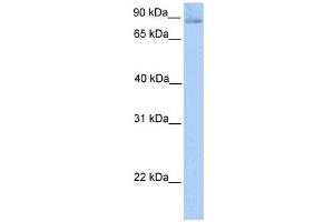 SLITRK1 antibody used at 1 ug/ml to detect target protein.