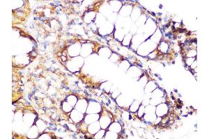 Immunohistochemistry of paraffin-embedded human colon using Clathrin heavy chain Rabbit mAb (ABIN7266404) at dilution of 1:100 (40x lens).