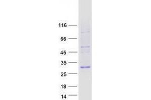 Validation with Western Blot