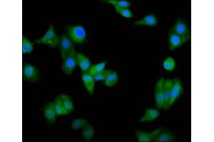 Immunofluorescence staining of HepG2 cells with ABIN7146463 at 1:66, counter-stained with DAPI. (Calicin anticorps  (AA 240-351))