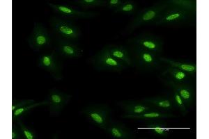 Immunofluorescence of monoclonal antibody to MBD5 on HeLa cell. (MBD5 anticorps  (AA 1-229))