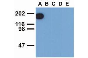 Western Blotting (WB) image for anti-Epidermal Growth Factor Receptor (EGFR) (pTyr1197) antibody (ABIN400879)