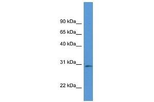 Western Blot showing Rpia antibody used at a concentration of 1. (Ribose 5-Phosphate Isomerase A (RPIA) (Middle Region) anticorps)