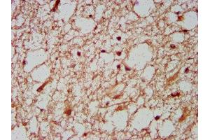 IHC image of ABIN7155757 diluted at 1:600 and staining in paraffin-embedded human brain tissue performed on a Leica BondTM system.