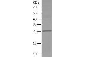 Western Blotting (WB) image for Proline-Rich Transmembrane Protein 2 (PRRT2) (AA 1-268) protein (His tag) (ABIN7124596)