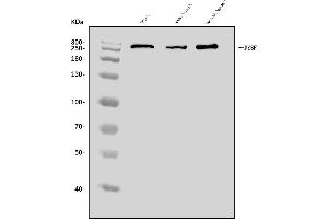 Western blot analysis of Dysferlin/DYSF using anti-Dysferlin/DYSF antibody (ABIN7601939).