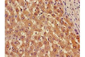 Immunohistochemistry of paraffin-embedded human liver tissue using ABIN7143681 at dilution of 1:100 (AOX1 anticorps  (AA 236-421))