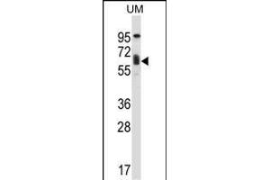 TCF3 Antibody (C-term) (ABIN657912 and ABIN2846860) western blot analysis in human uterine tumor tissue lysates (35 μg/lane). (TCF3 anticorps  (C-Term))