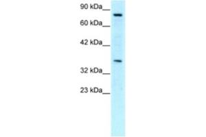 Western Blotting (WB) image for anti-Neuronal PAS Domain Protein 1 (NPAS1) antibody (ABIN2460366) (NPAS1 anticorps)