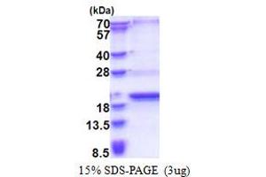 SDS-PAGE (SDS) image for SCP2 Sterol-Binding Domain Containing 1 (SCP2D1) (AA 1-156) protein (His tag) (ABIN6387408)