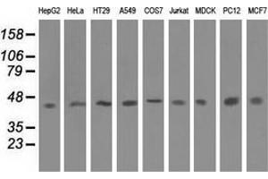 Western blot analysis of extracts (35 µg) from 9 different cell lines by using anti-IVD monoclonal antibody. (IVD anticorps)