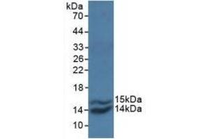 Detection of Recombinant MCP1, Simian using Polyclonal Antibody to Monocyte Chemotactic Protein 1 (MCP1) (CCL2 anticorps  (AA 24-99))