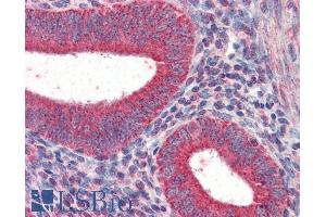 ABIN184983 (5µg/ml) staining of paraffin embedded Human Uterus. (TRIM5 anticorps  (N-Term))