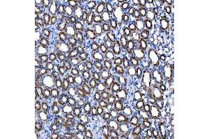 IHC analysis of SUCLG2 using anti-SUCLG2 antibody (ABIN7601694). (SUCLG2 anticorps  (AA 42-424))