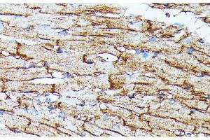 Immunohistochemistry of paraffin-embedded Mouse heart using SLC14A1 Polyclonal Antibody at dilution of 1:100 (40x lens). (SLC14A1 anticorps)