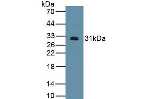 Detection of Recombinant IL2Ra, Mouse using Polyclonal Antibody to Interleukin 2 Receptor Alpha (IL2Ra)