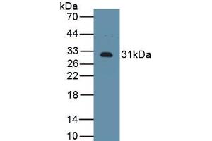 Detection of Recombinant IL2Ra, Mouse using Polyclonal Antibody to Interleukin 2 Receptor Alpha (IL2Ra) (CD25 anticorps  (AA 22-235))