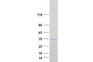Validation with Western Blot
