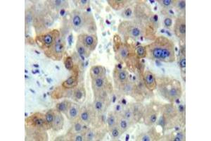 Used in DAB staining on fromalin fixed paraffin-embedded Liver tissue