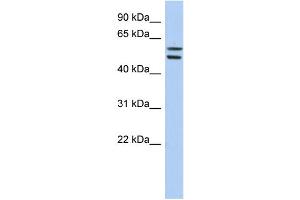 WB Suggested Anti-ZNF513 Antibody Titration:  0. (ZNF513 anticorps  (Middle Region))