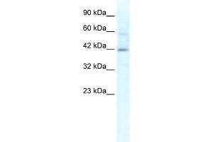 WB Suggested Anti-KCTD10 Antibody Titration:  1. (KCTD10 anticorps  (N-Term))