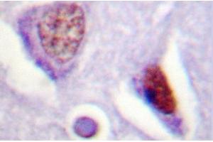 Image no. 2 for anti-Nuclear Receptor Subfamily 5, Group A, Member 1 (NR5A1) antibody (ABIN272078)