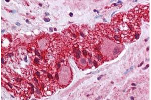 Human Colon, Myenteric Plexus: Formalin-Fixed, Paraffin-Embedded (FFPE) (LMBRD1 anticorps  (C-Term))