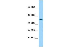 Western Blotting (WB) image for anti-Taste Receptor, Type 1, Member 1 (TAS1R1) (C-Term) antibody (ABIN2790236) (TAS1R1 anticorps  (C-Term))