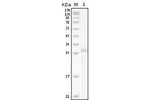 Western blot analysis using HER-2 mouse mAb against truncated HER-2 recombinant protein.